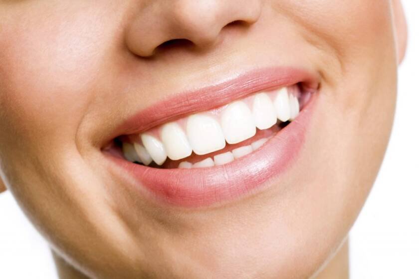Teeth Whitening Procedure